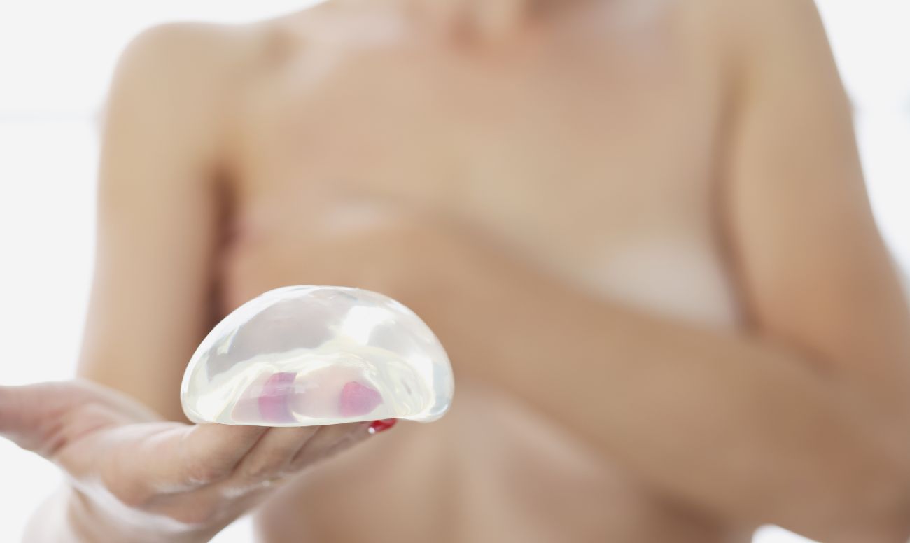 Reconstrucción de implantes mamarios - Procedimientos